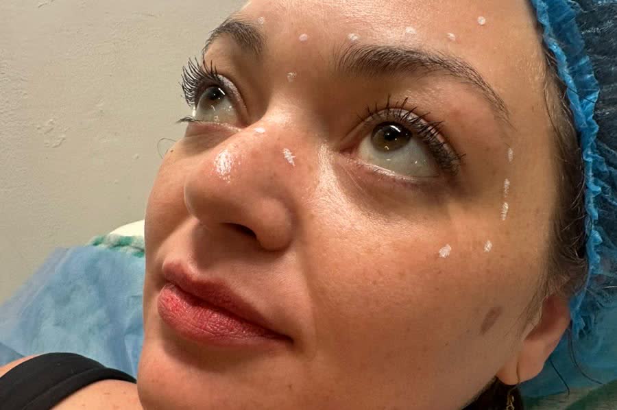 Face before contouring treatment