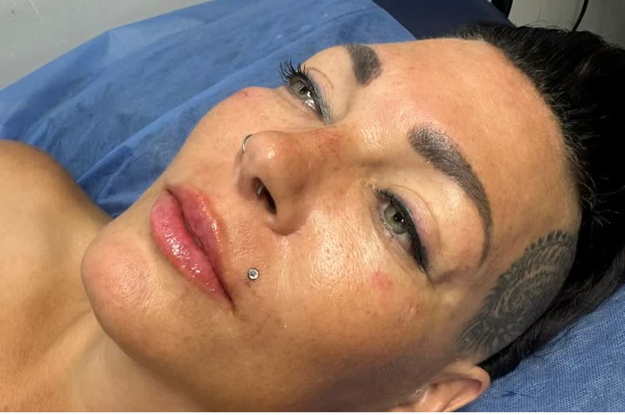 Profile after nose refinement