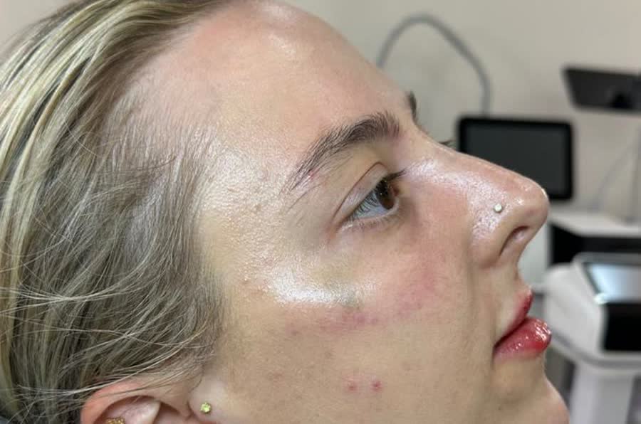 Lips and skin after treatment
