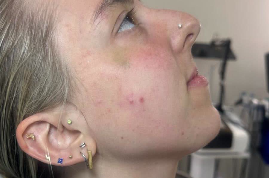 Lips and skin before treatment