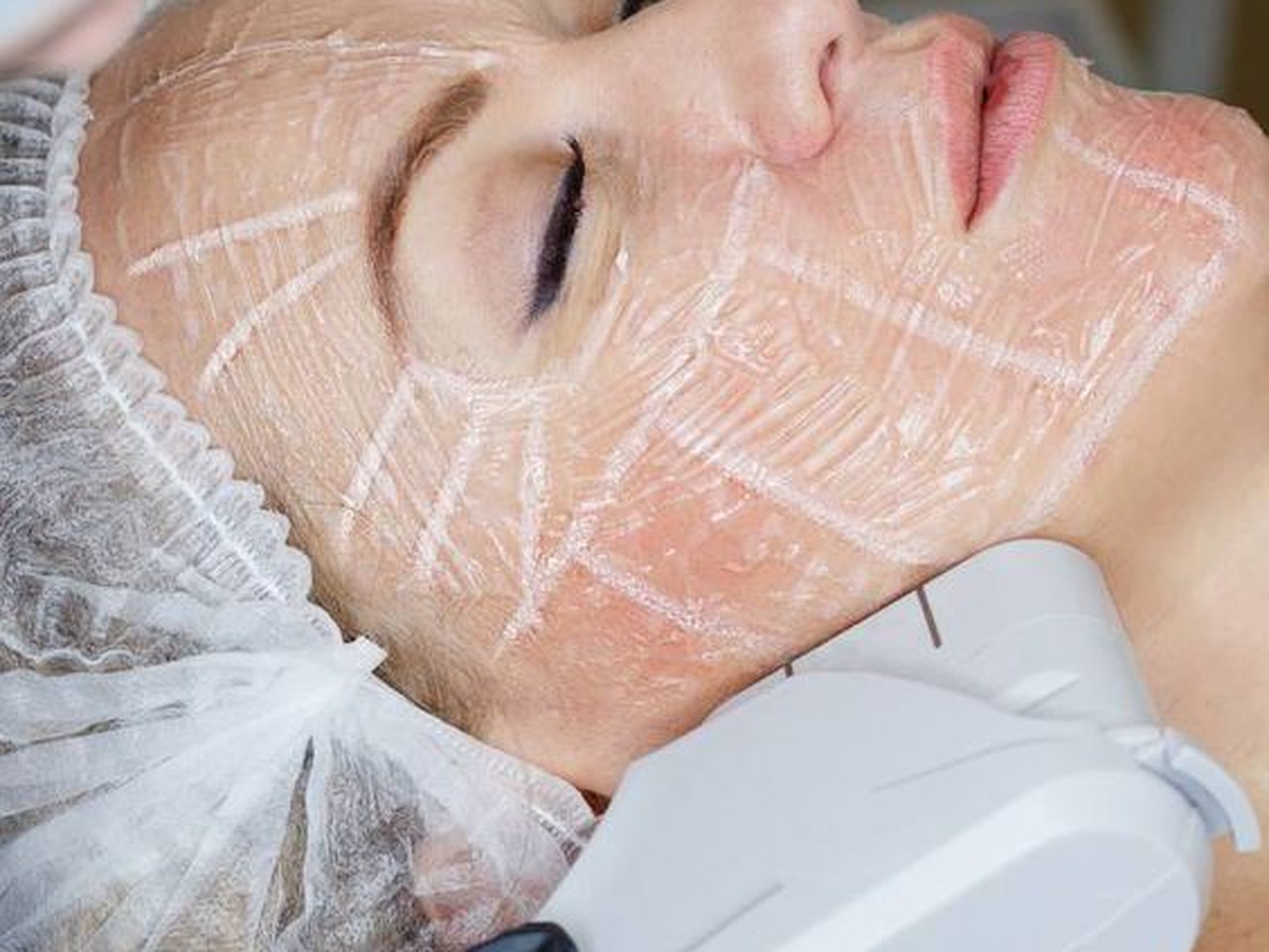 HIFU skin tightening treatment at Coconut Botox Tulum