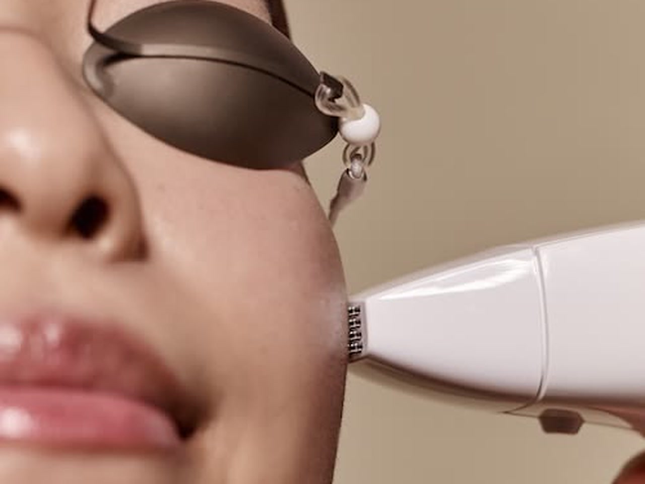 Facial laser treatment at Coconut Botox Tulum
